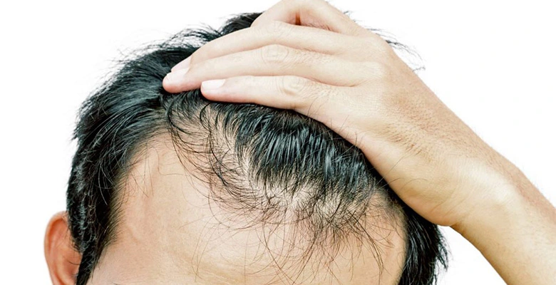 SKIN CLINIC Post Hair Transplants are Now at the Lowest Cost
