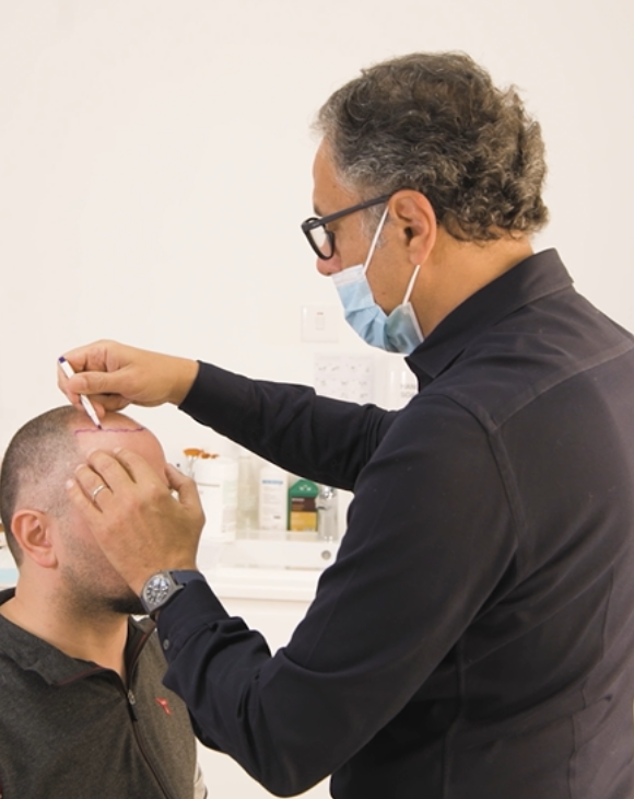 Dr. Dany Touma drawing a natural hairline on a man's head for hair transplantation
